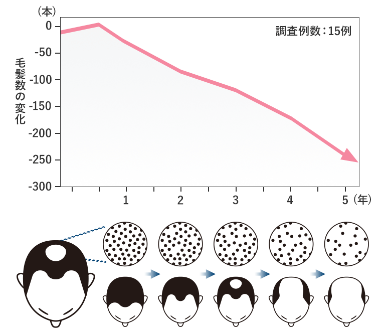 毛髪量の変化