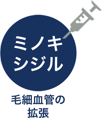 ミノキシジル