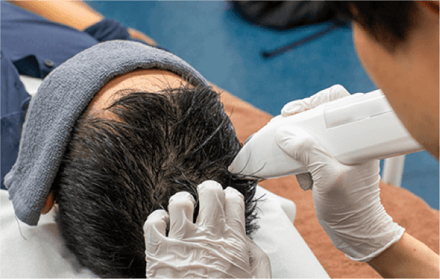 MINOXI JET(ミノキジェット)