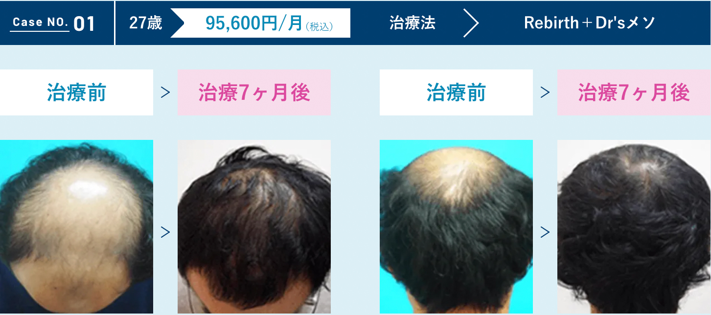 症例1